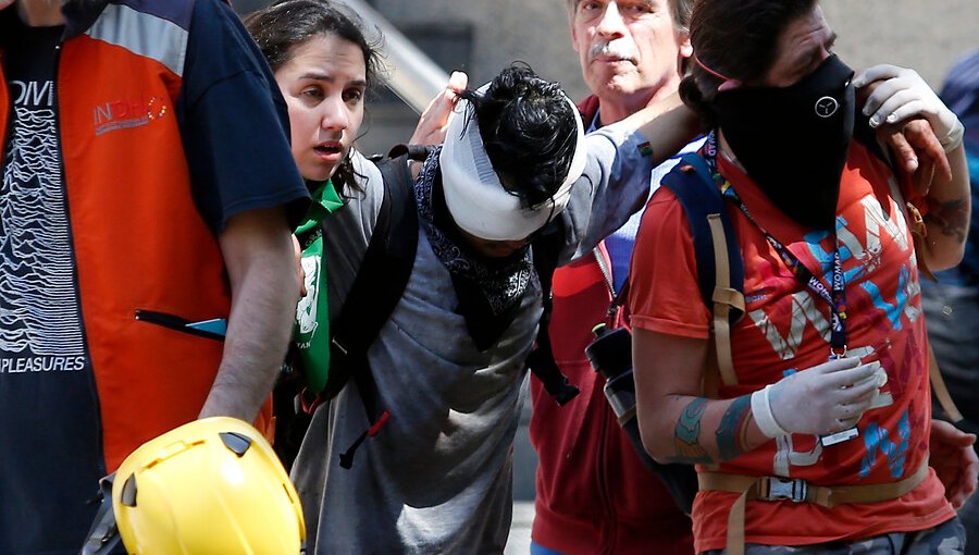 194 personas han sido atendidas por daño ocular, 12 con pérdida total o parcial en el último mes