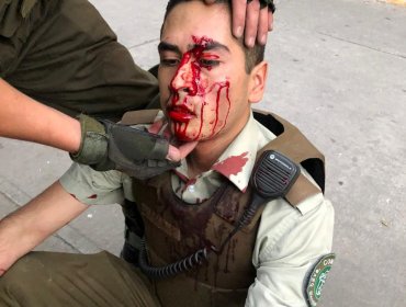 Turba atacó violentamente a Carabineros que se desplazaban en radiopatrulla por Recoleta