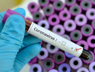 Cifra de contagiados por coronavirus asciende a 33: 10 nuevos casos en las últimas 24 horas