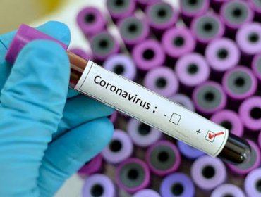 Confirman primer caso de coronavirus en la región de Valparaíso: viñamarino se contagió en Santiago