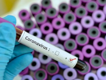 Ministerio de Salud modifica definición de un caso sospechoso de coronavirus tras ingresar a Fase 4