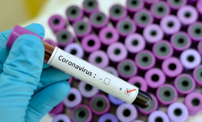 Ministerio de Salud modifica definición de un caso sospechoso de coronavirus tras ingresar a Fase 4