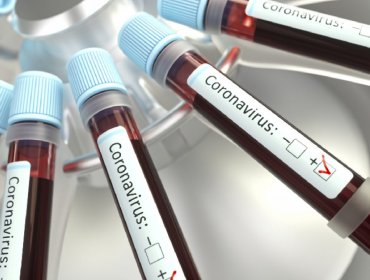 Intendencia confirma nuevo caso de coronavirus en la región de Magallanes