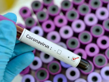 Síntomas del coronavirus: ¿Cómo diferenciar el Covid-19 de otros síndromes respiratorios?