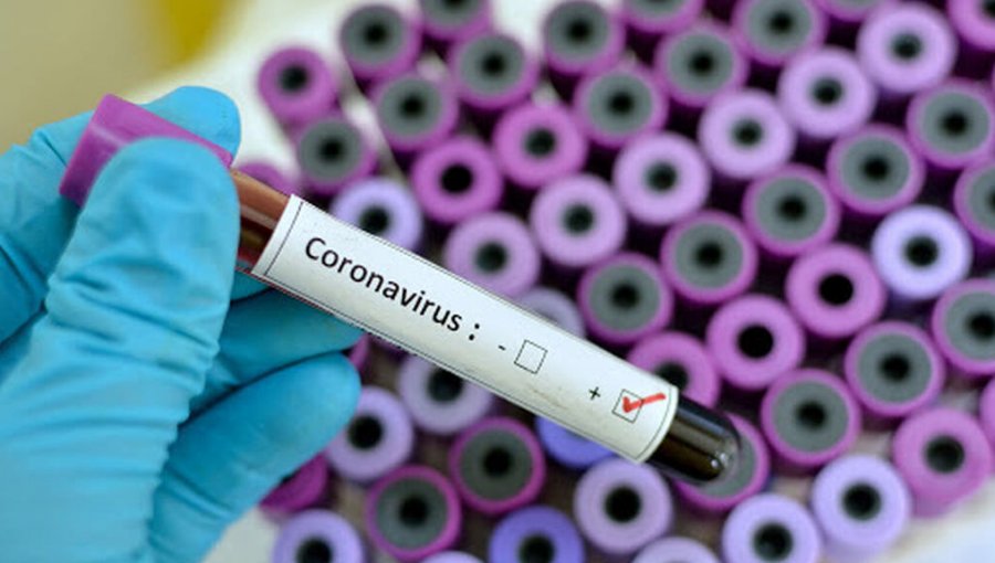 Síntomas del coronavirus: ¿Cómo diferenciar el Covid-19 de otros síndromes respiratorios?