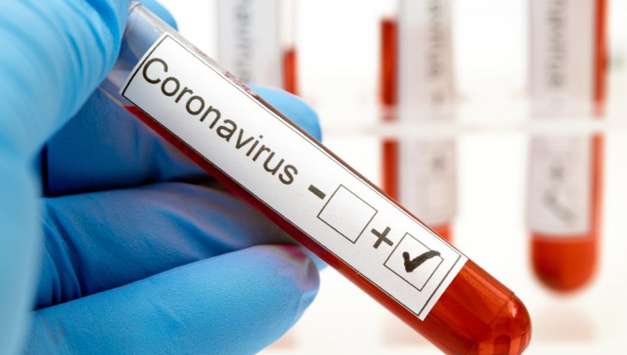 Pandemia habría llegado a Chile unos 10 días antes del primer caso confirmado en El Maule