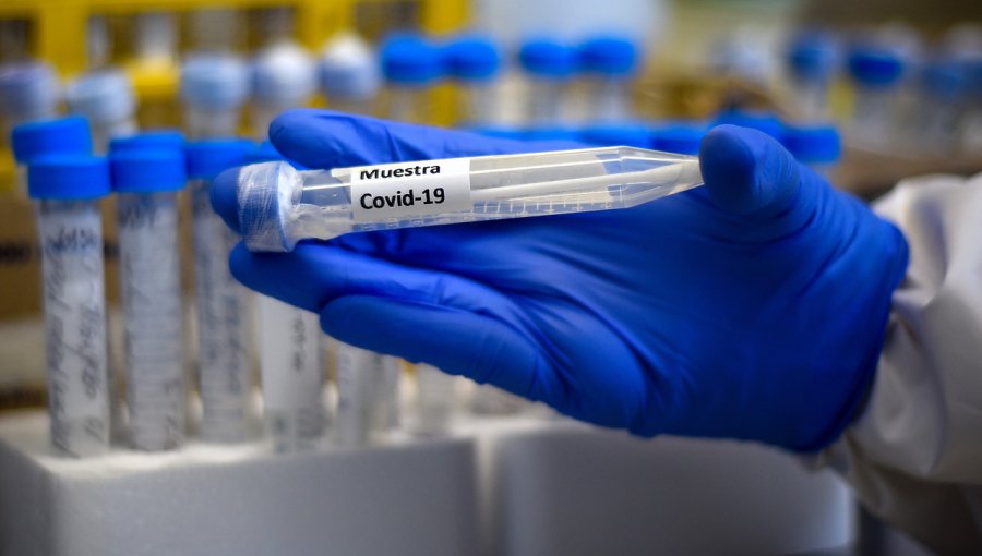 1.427 personas dieron "positivo" al test de coronavirus en las últimas 24 horas en Chile