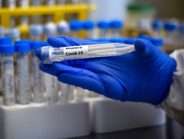 1.427 personas dieron "positivo" al test de coronavirus en las últimas 24 horas en Chile