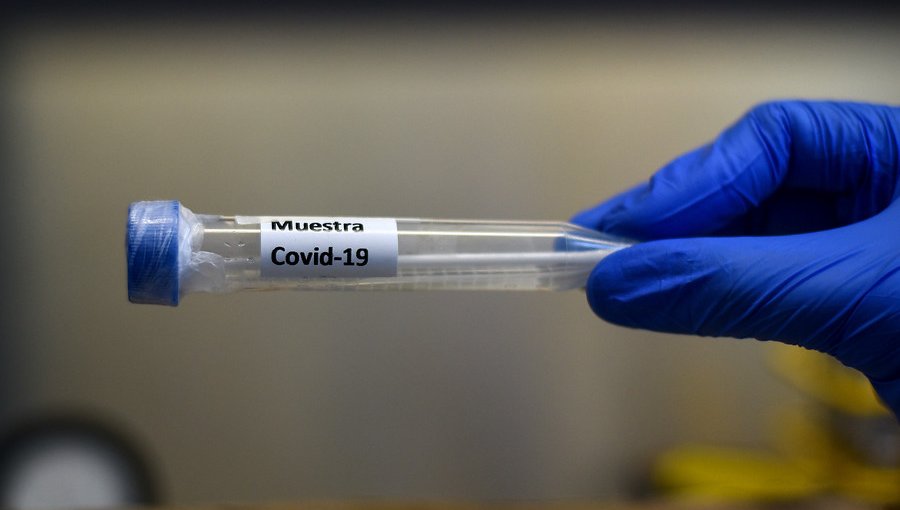 15° informe epidemiológico: 37% de aumento de casos activos de Covid-19 en región Metropolitana en tres días