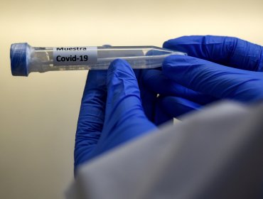 Región de Valparaíso reporta 50 casos nuevos de coronavirus Covid-19