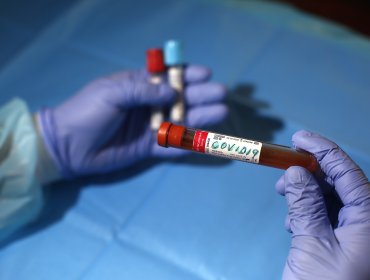 1.647 nuevos casos: En las últimas 24 horas se suma la mayor cantidad de contagios desde que inicio la pandemia