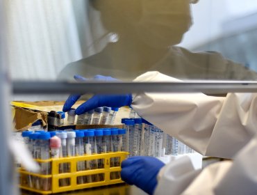 Ministerio de Salud asegura que la red pública dispone de capacidad y stock para realizar exámenes PCR