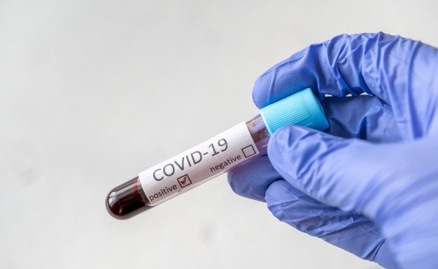 La OMS advierte que el Covid-19 podría convertirse en un virus endémico y "no irse nunca"