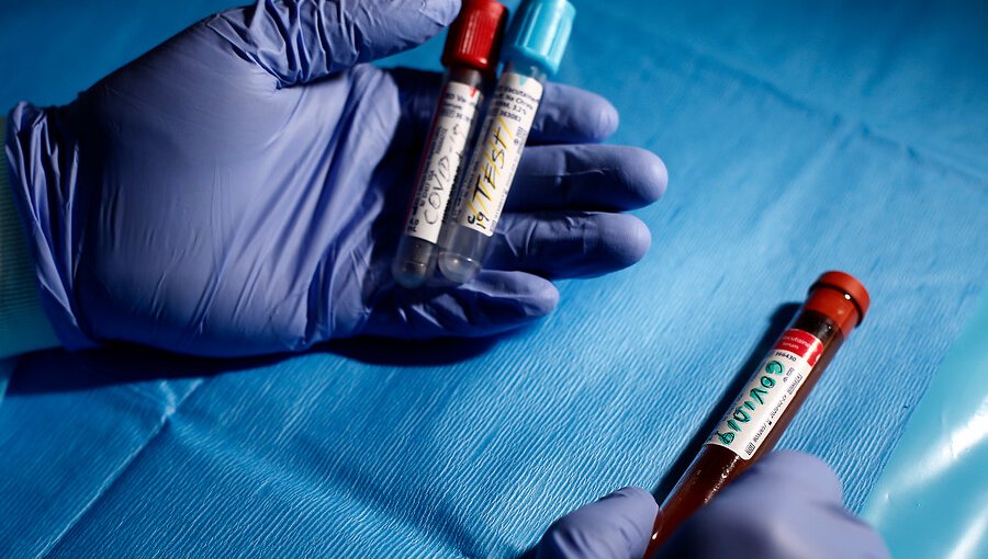 Ministerio de Salud asegura que hay 360 mil exámanes PCR disponibles en el sistema público