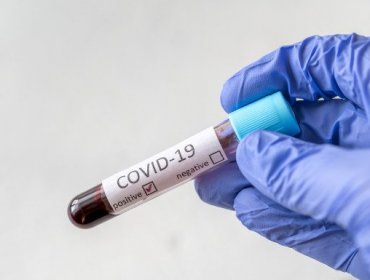 La OMS advierte que el Covid-19 podría convertirse en un virus endémico y "no irse nunca"