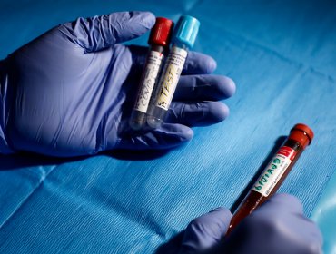 Ministerio de Salud asegura que hay 360 mil exámanes PCR disponibles en el sistema público