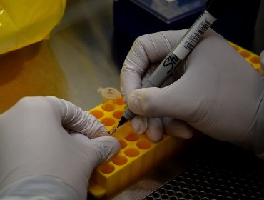 Ministerio de Salud suspende permisos a cinco laboratorios por errores en resultados de test por coronavirus