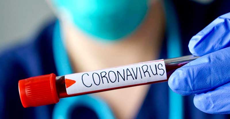 Covid-19: Chile sigue aumentado los muertos por día: 29 fallecidos y acumulado llega a 450 en todo el país
