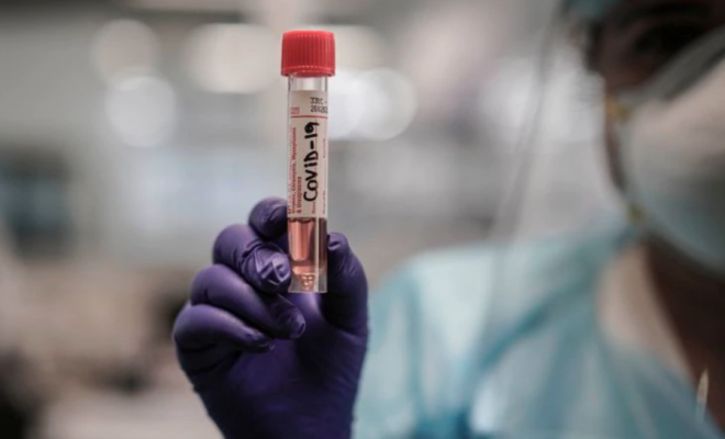 4.895 personas dieron positivo por coronavirus el último día en Chile: total asciende a 73.997 casos
