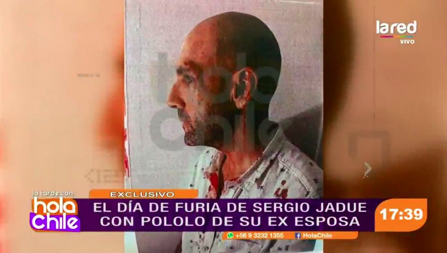 Salen a la luz imágenes de Sergio Jadue ensangrentado tras pelea en Miami