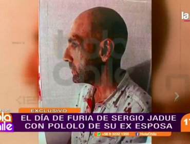 Salen a la luz imágenes de Sergio Jadue ensangrentado tras pelea en Miami