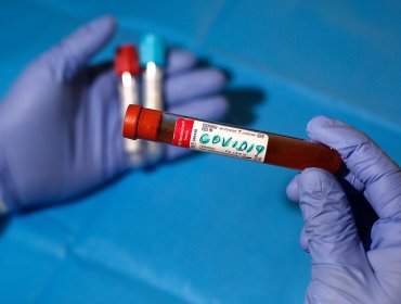 4.207 casos nuevos elevan cifra de contagiados con coronavirus a 122.499 personas