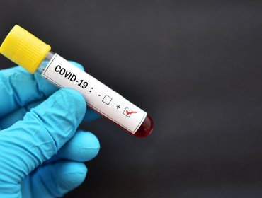 223 casos nuevos de coronavirus en la región de Valparaíso: 1.429 personas son casos activos