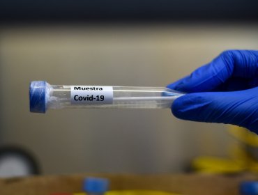 Región de Valparaíso supera los 13 mil casos de coronavirus: 1.908 son activos y 10.878 están recuperados