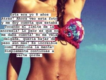 "El límite de la anorexia": Lisanda Silva impacta con imagen del recuerdo y potente mensaje