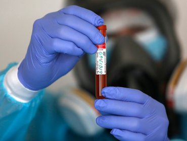 El mundo superó los 20 millones de casos confirmados de coronavirus