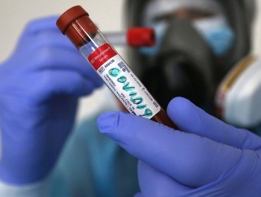 Últimas 24 horas de Coronavirus en Chile: 1.600 nuevos contagiados y 32 fallecimientos