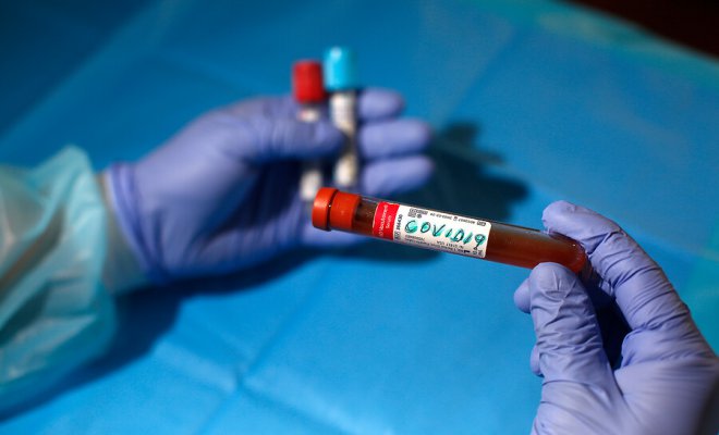 Funcionaria del Ministerio de Salud declara ante fiscal que se creó un "un sistema paralelo" para informar casos de Covid-19