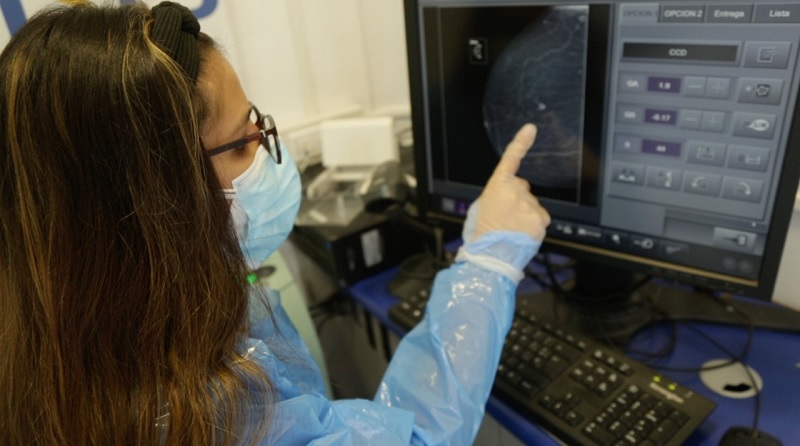 36 mujeres de Limache se realizaron mamografías en el marco de campaña preventiva