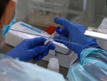 237 nuevos contagios y 1.620 casos activos de coronavirus reporta la región de Valparaíso