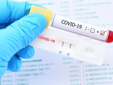 Tasa de positividad en la región de Valparaíso batió todos los récords: 17% de los exámenes de PCR confirmaron Covid-19