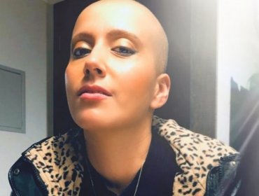 Mila Correa fue hospitalizada por Covid-19 en medio de su lucha contra el cáncer: "por culpa de irresponsabilidad de terceros"