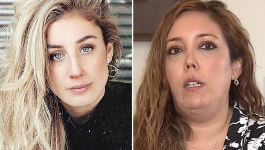 Daniela Castro y denuncia de mujer atacada por su perro: “Mantuve silencio por respeto a la víctima”