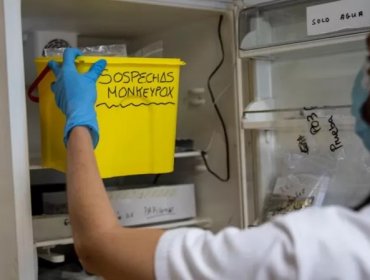 Ministerio de Salud venezolano informó que detectó el primer caso de un paciente contagiado con la viruela del mono