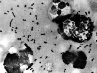 Dientes antiguos revelan dónde se originó la peste negra, la más mortífera de la historia