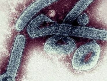 OMS en alerta por los primeros dos casos confirmados del mortal virus de Marburgo en Ghana