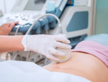 Ovarios poliquísticos: Las dudas frecuentes al planificar un embarazo