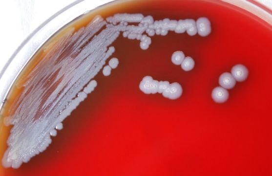 La peligrosa bacteria encontrada en Estados Unidos que preocupa a las autoridades de salud del país