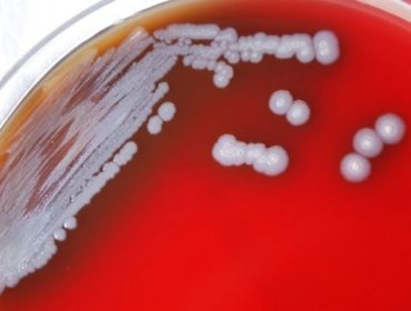 La peligrosa bacteria encontrada en Estados Unidos que preocupa a las autoridades de salud del país