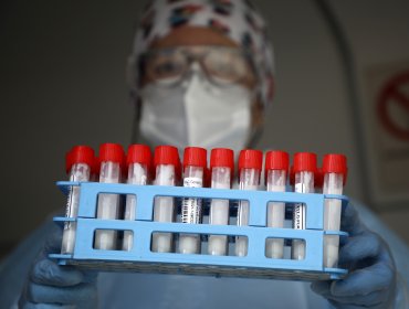 Contagios nuevos por coronavirus superan los 3 mil y casos activos llegan a 14.424 en Chile