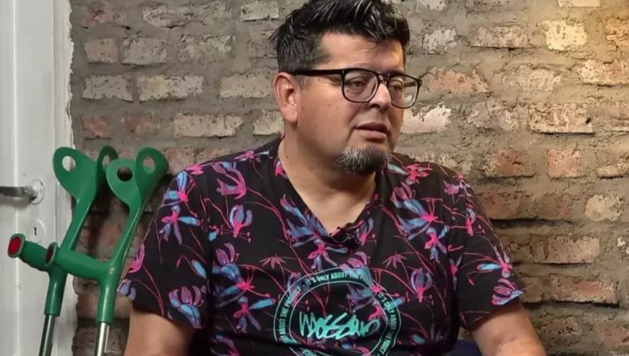 Mauricio Medina sobre la compleja amputación que debió realizarse por la diabetes: “Fue culpa mía”
