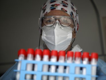 Ministerio de Salud confirma que en Chile se han reportado más de 100 contagios de Covid con nueva variante XBB