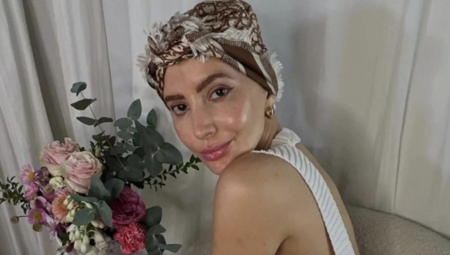 Aylén Milla entregó detalles de cómo la quimioterapia ha afectado su cuerpo: “Más fuertes, me pegaron”