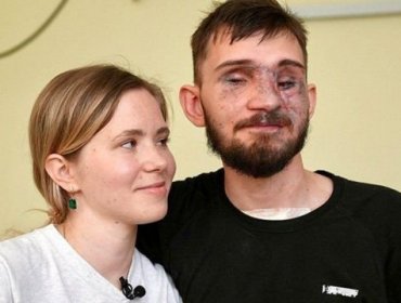 “Se necesita una nueva definición de belleza en Ucrania”: El creciente número de amputados en la guerra contra Rusia