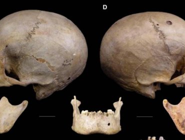 Cráneo de 4 mil años de antigüedad revela cómo los egipcios trataron de operar el cáncer