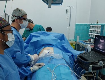 Realizan innovador procedimiento para “quemar” tumor hepático con energía de microondas en Hospital Pereira de Valparaíso